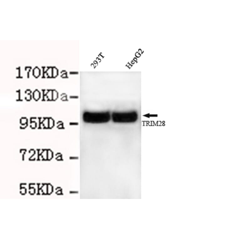 TRIM28 Monoclonal Antibody from Signalway Antibody (27026) - Antibodies.com