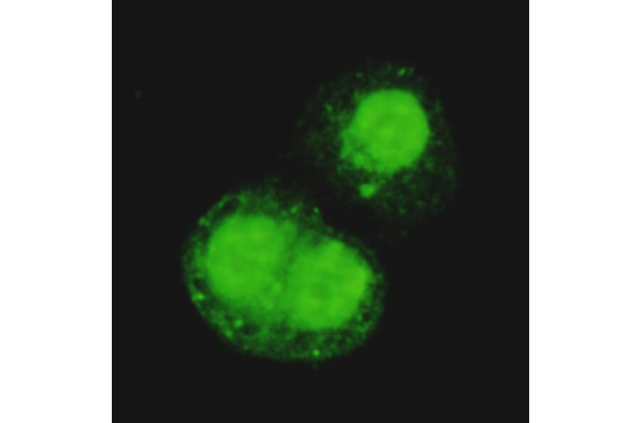 TRIM28 Monoclonal Antibody from Signalway Antibody (27026) - Antibodies.com