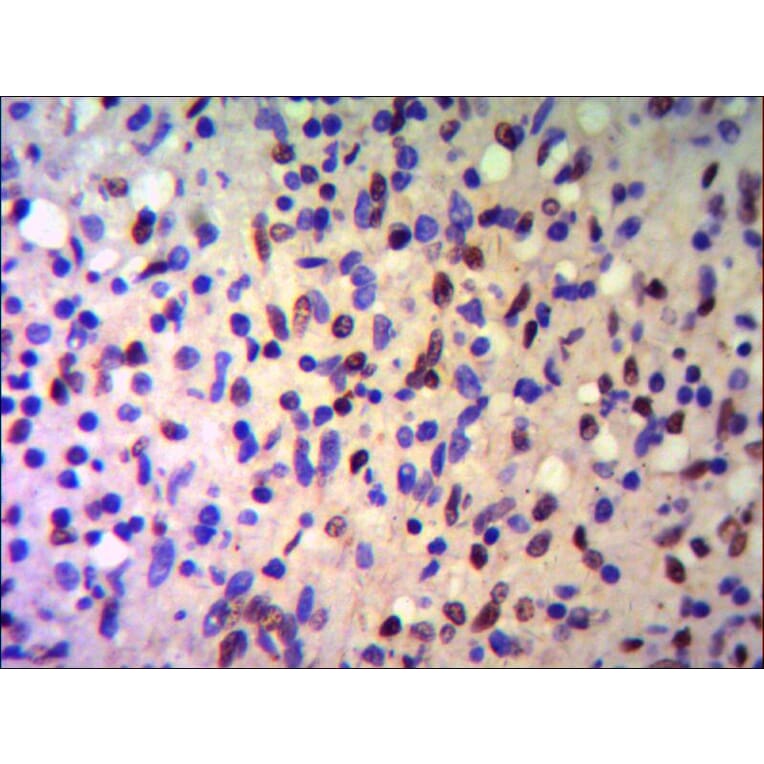 TRIM28 Monoclonal Antibody from Signalway Antibody (27026) - Antibodies.com