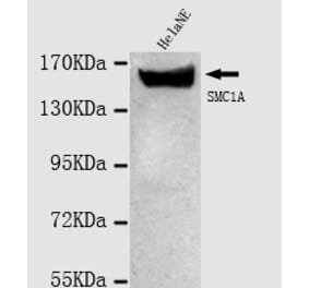 SMC1A (N-term) Monoclonal Antibody from Signalway Antibody (27022) - Antibodies.com