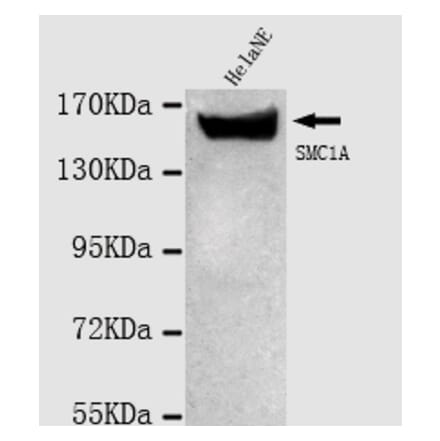 SMC1A (N-term) Monoclonal Antibody from Signalway Antibody (27022) - Antibodies.com