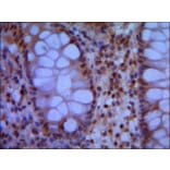 SMC1A (N-term) Monoclonal Antibody from Signalway Antibody (27022) - Antibodies.com