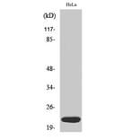 Western blot - Dynein LC 1 Polyclonal Antibody from Signalway Antibody (40857) - Antibodies.com
