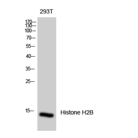 Western blot - Histone H2B Polyclonal Antibody from Signalway Antibody (41015) - Antibodies.com