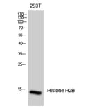Western blot - Histone H2B Polyclonal Antibody from Signalway Antibody (41015) - Antibodies.com