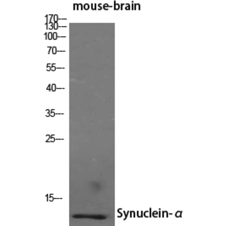 Western blot - Synuclein-α Polyclonal Antibody from Signalway Antibody (41473) - Antibodies.com