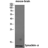 Western blot - Synuclein-α Polyclonal Antibody from Signalway Antibody (41473) - Antibodies.com