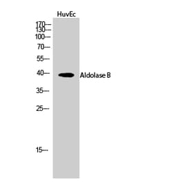 Western blot - Aldolase B Polyclonal Antibody from Signalway Antibody (40582) - Antibodies.com