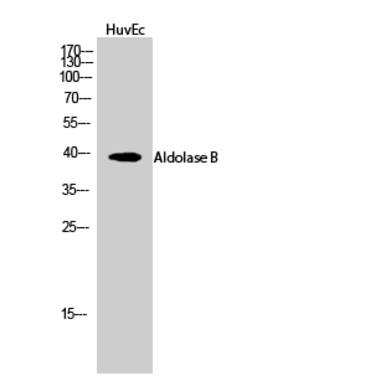 Western blot - Aldolase B Polyclonal Antibody from Signalway Antibody (40582) - Antibodies.com