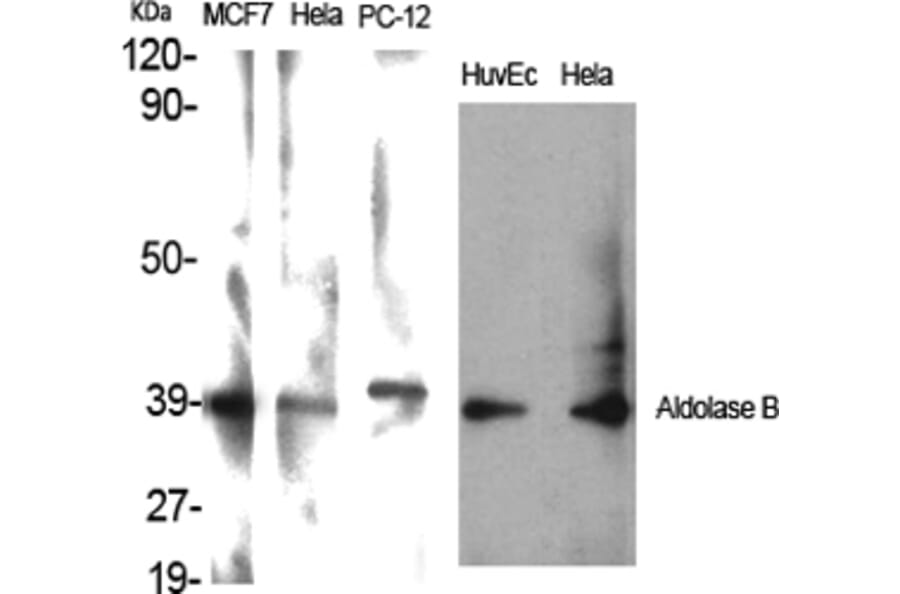 Western blot - Aldolase B Polyclonal Antibody from Signalway Antibody (40582) - Antibodies.com