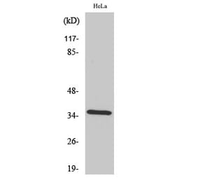 Western blot - Annexin II Polyclonal Antibody from Signalway Antibody (40592) - Antibodies.com