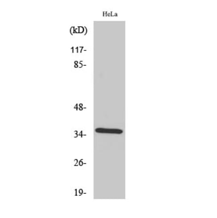 Western blot - Annexin II Polyclonal Antibody from Signalway Antibody (40592) - Antibodies.com