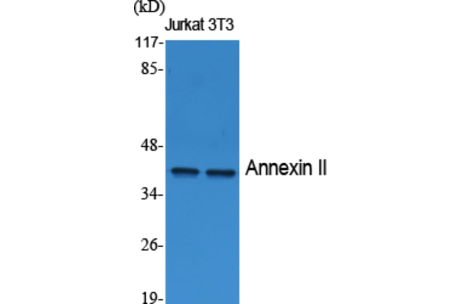 Western blot - Annexin II Polyclonal Antibody from Signalway Antibody (40592) - Antibodies.com
