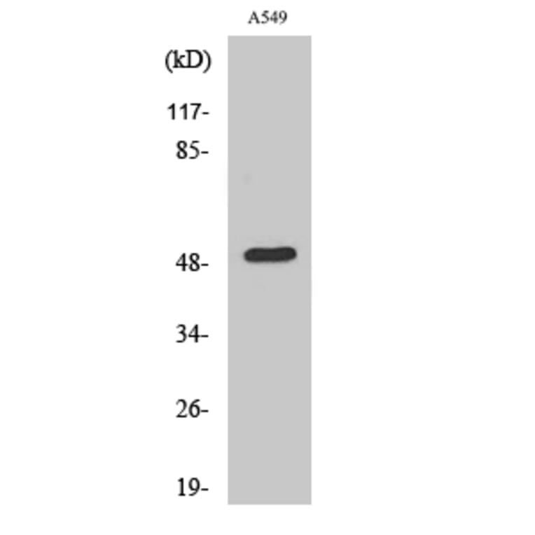 Western blot - Dynactin 2 Polyclonal Antibody from Signalway Antibody (40856) - Antibodies.com