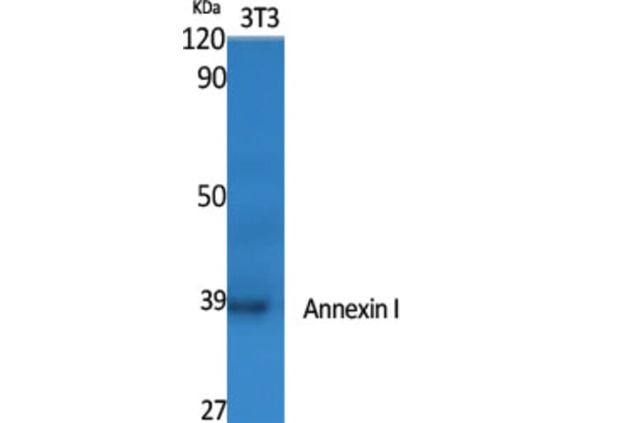 Western blot - Annexin I Polyclonal Antibody from Signalway Antibody (40590) - Antibodies.com