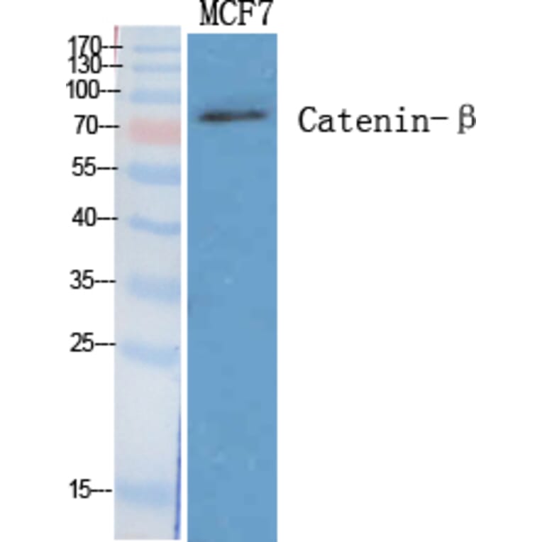 Western blot - Catenin-β Polyclonal Antibody from Signalway Antibody (40682) - Antibodies.com