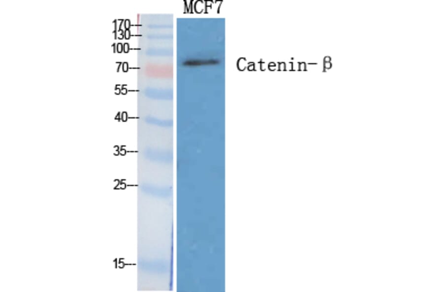 Western blot - Catenin-β Polyclonal Antibody from Signalway Antibody (40682) - Antibodies.com
