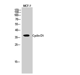 Western blot - Cyclin D1 Polyclonal Antibody from Signalway Antibody (40803) - Antibodies.com