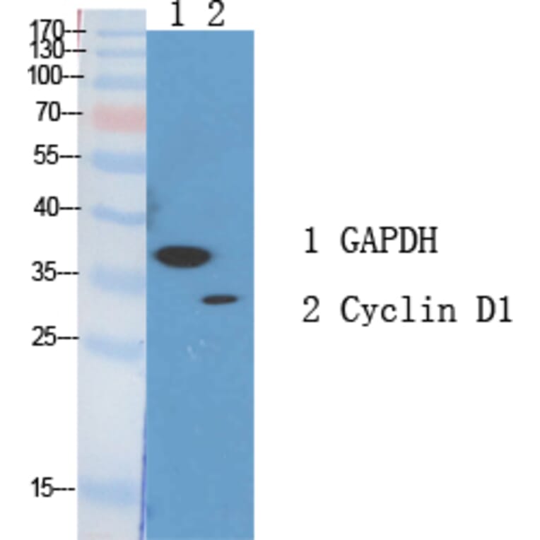 Western blot - Cyclin D1 Polyclonal Antibody from Signalway Antibody (40803) - Antibodies.com