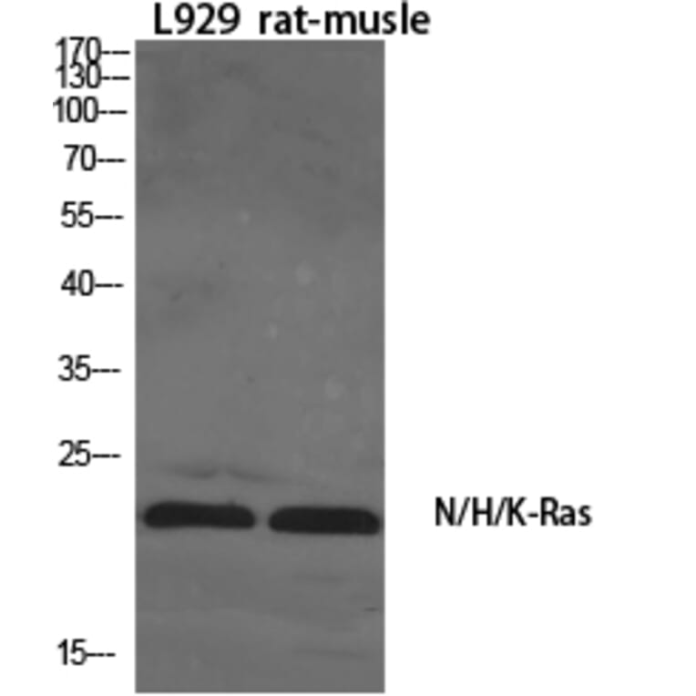 Western blot - N/H/K-Ras Polyclonal Antibody from Signalway Antibody (41199) - Antibodies.com