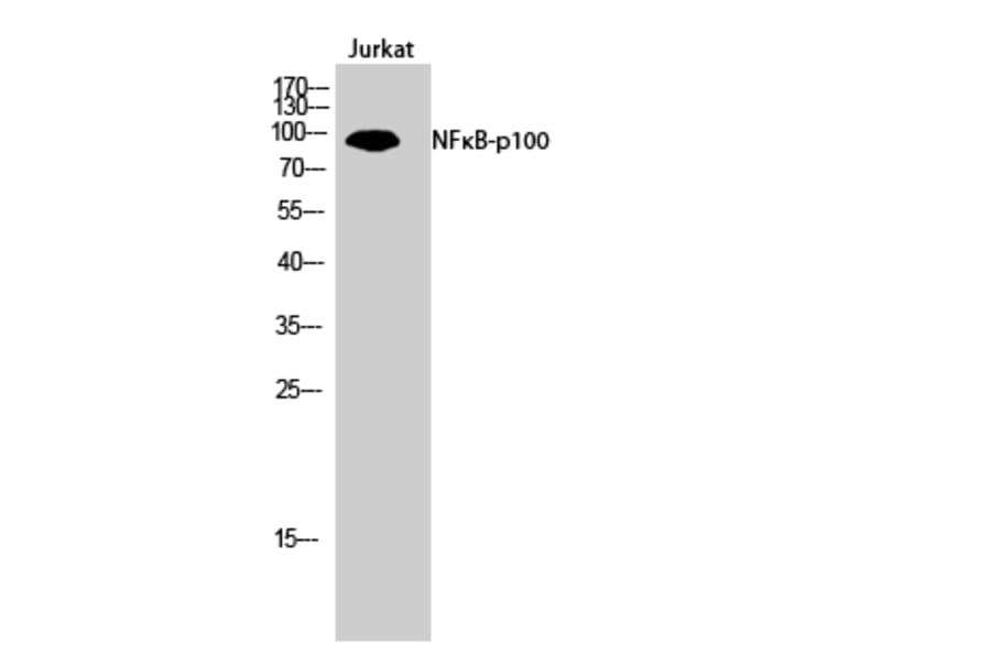 Western blot - NFκB-p100 Polyclonal Antibody from Signalway Antibody (41224) - Antibodies.com