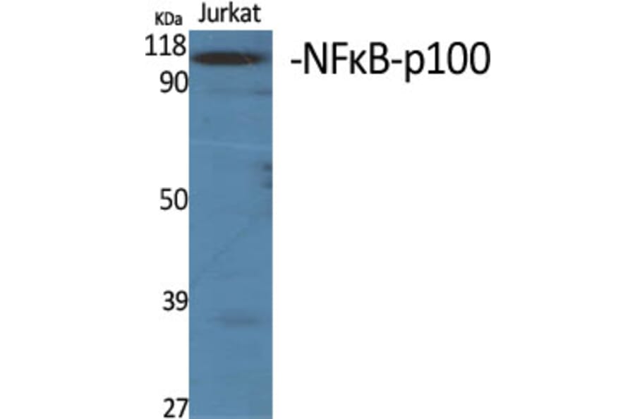 Western blot - NFκB-p100 Polyclonal Antibody from Signalway Antibody (41224) - Antibodies.com