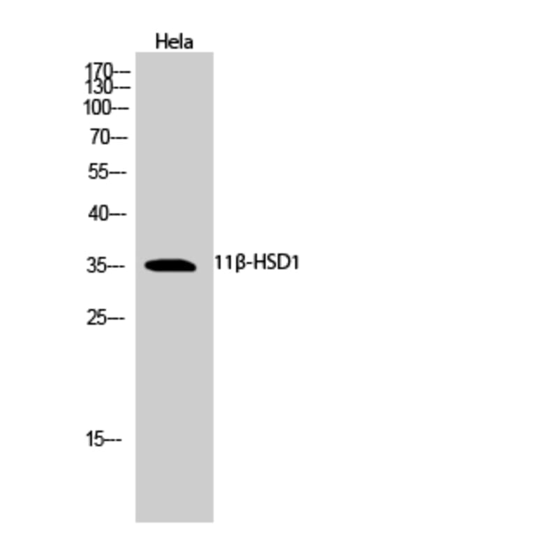 Western blot - 11β-HSD1 Polyclonal Antibody from Signalway Antibody (40522) - Antibodies.com