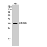 Western blot - 11β-HSD1 Polyclonal Antibody from Signalway Antibody (40522) - Antibodies.com