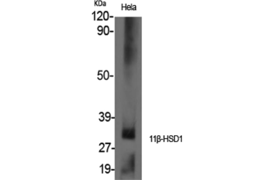 Western blot - 11β-HSD1 Polyclonal Antibody from Signalway Antibody (40522) - Antibodies.com