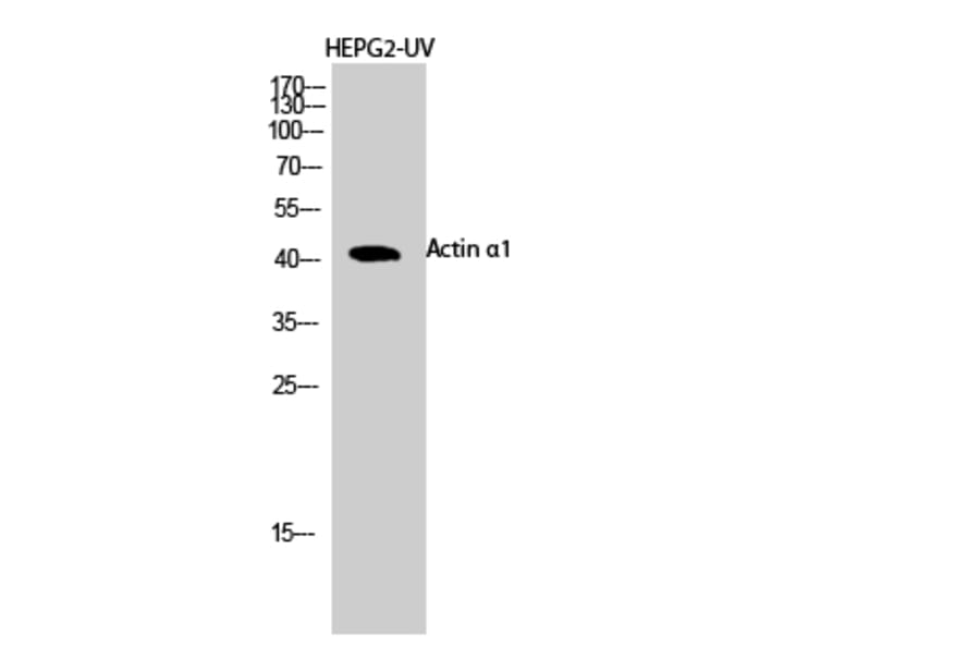 Western blot - Actin α1 Polyclonal Antibody from Signalway Antibody (40550) - Antibodies.com