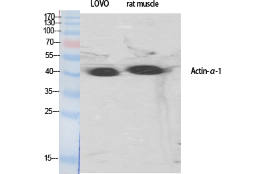 Western blot - Actin α1 Polyclonal Antibody from Signalway Antibody (40550) - Antibodies.com