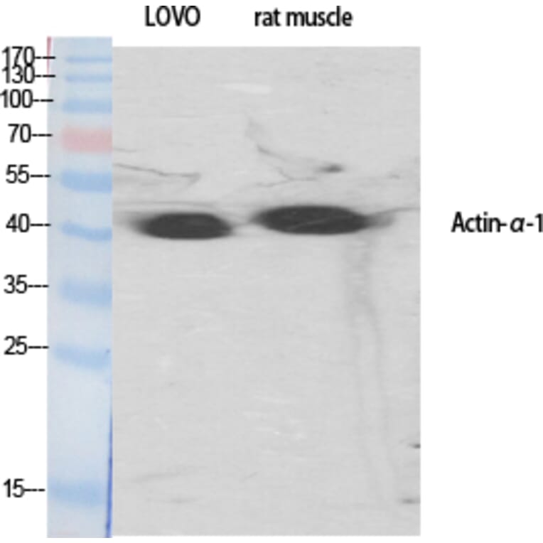 Western blot - Actin α1 Polyclonal Antibody from Signalway Antibody (40550) - Antibodies.com