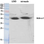 Western blot - Actin α1 Polyclonal Antibody from Signalway Antibody (40550) - Antibodies.com