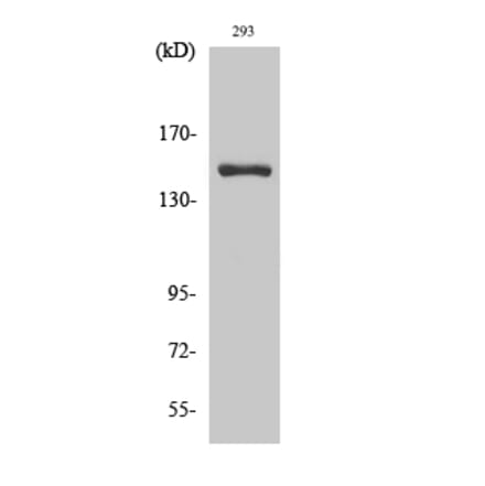 Western blot - ANKRD30A Polyclonal Antibody from Signalway Antibody (40589) - Antibodies.com
