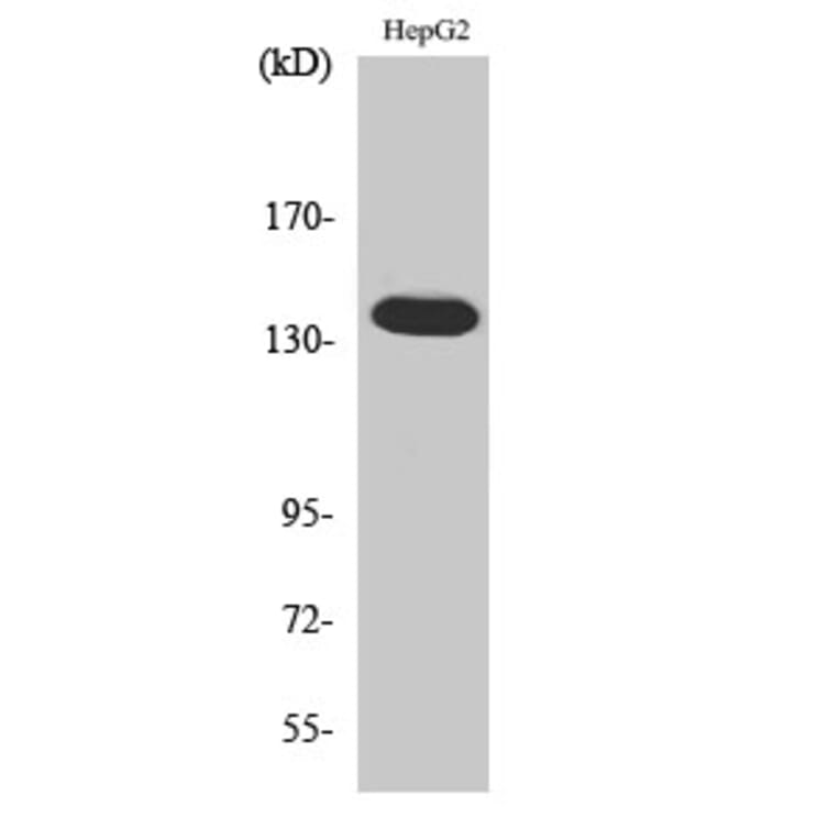 Western blot - Ataxin-2 Polyclonal Antibody from Signalway Antibody (40622) - Antibodies.com