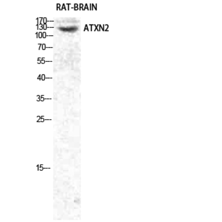 Western blot - Ataxin-2 Polyclonal Antibody from Signalway Antibody (40622) - Antibodies.com