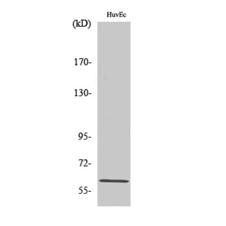 Western blot - CCDC102B Polyclonal Antibody from Signalway Antibody (40689) - Antibodies.com