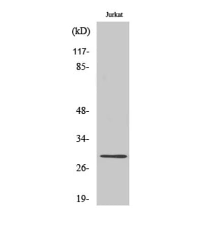 Western blot - Cyclin G Polyclonal Antibody from Signalway Antibody (40806) - Antibodies.com