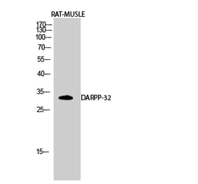 Western blot - DARPP-32 Polyclonal Antibody from Signalway Antibody (40833) - Antibodies.com