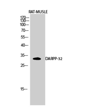 Western blot - DARPP-32 Polyclonal Antibody from Signalway Antibody (40833) - Antibodies.com