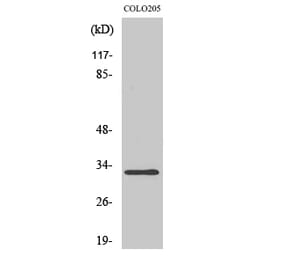 Western blot - DARPP-32 Polyclonal Antibody from Signalway Antibody (40834) - Antibodies.com