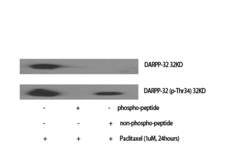 Western blot - DARPP-32 Polyclonal Antibody from Signalway Antibody (40834) - Antibodies.com