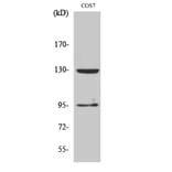 Western blot - GABAB R1 Polyclonal Antibody from Signalway Antibody (40945) - Antibodies.com