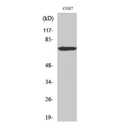 Western blot - LIMK-1/2 Polyclonal Antibody from Signalway Antibody (41108) - Antibodies.com
