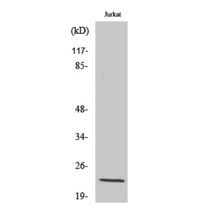 Western blot - Musculin Polyclonal Antibody from Signalway Antibody (41190) - Antibodies.com