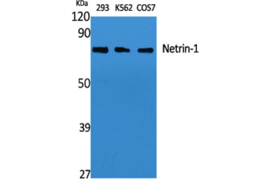 Western blot - Netrin-1 Polyclonal Antibody from Signalway Antibody (41215) - Antibodies.com