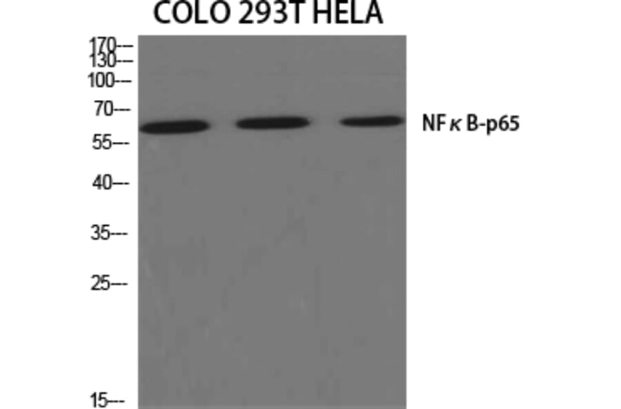 Western blot - NFκB-p65 Polyclonal Antibody from Signalway Antibody (41228) - Antibodies.com