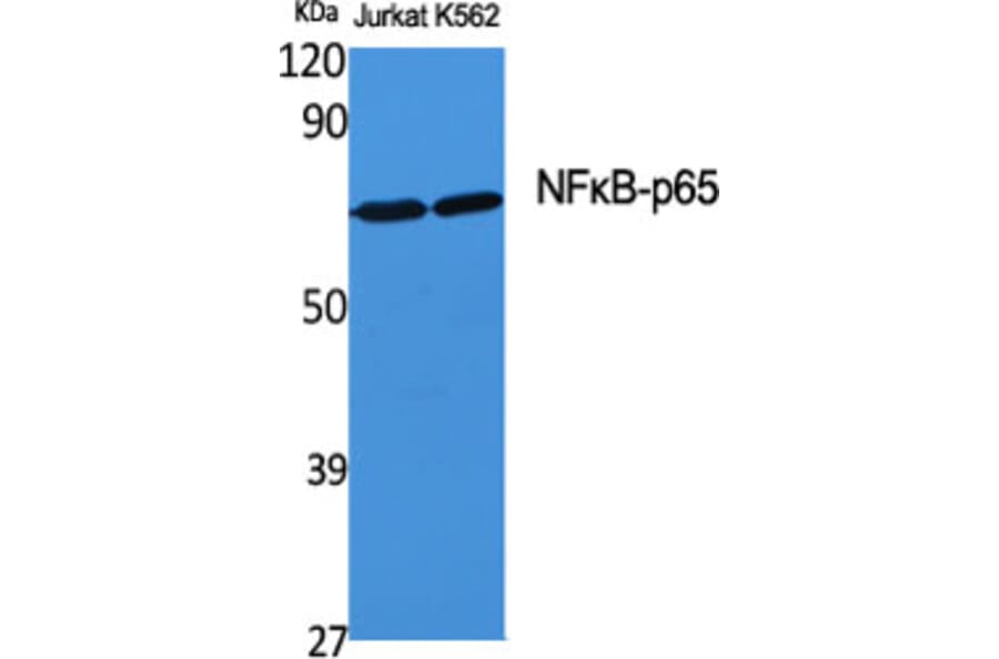 Western blot - NFκB-p65 Polyclonal Antibody from Signalway Antibody (41230) - Antibodies.com