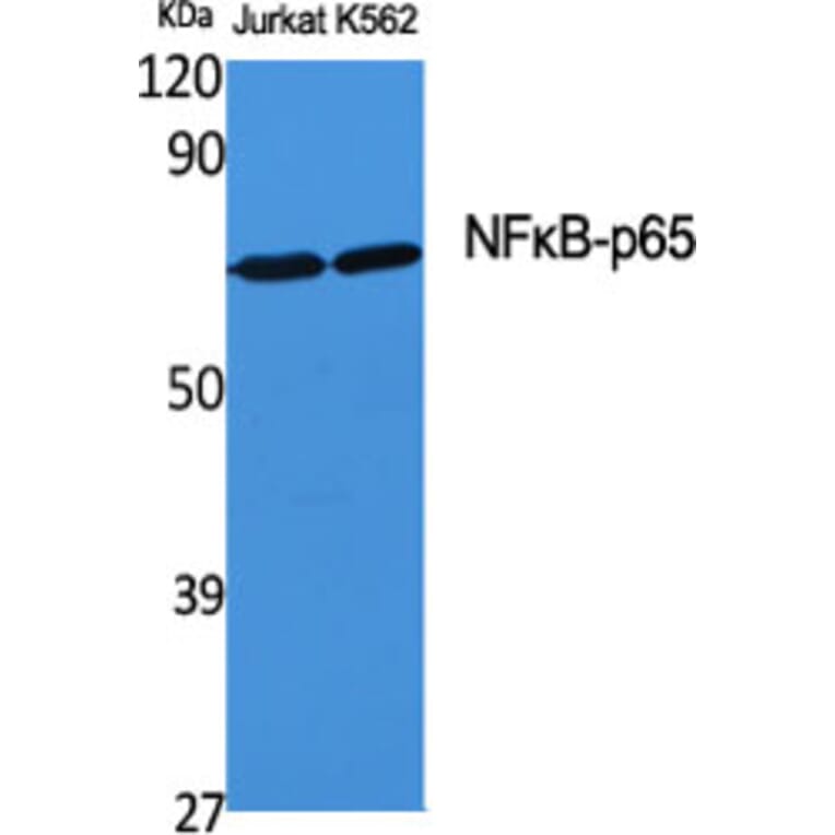 Western blot - NFκB-p65 Polyclonal Antibody from Signalway Antibody (41230) - Antibodies.com