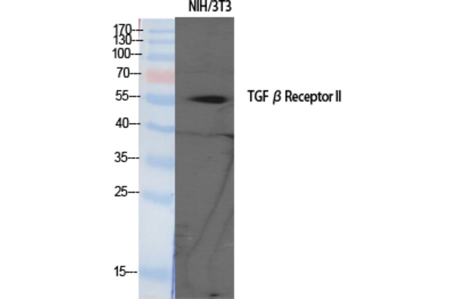 Western blot - TGFβ RII Polyclonal Antibody from Signalway Antibody (41492) - Antibodies.com